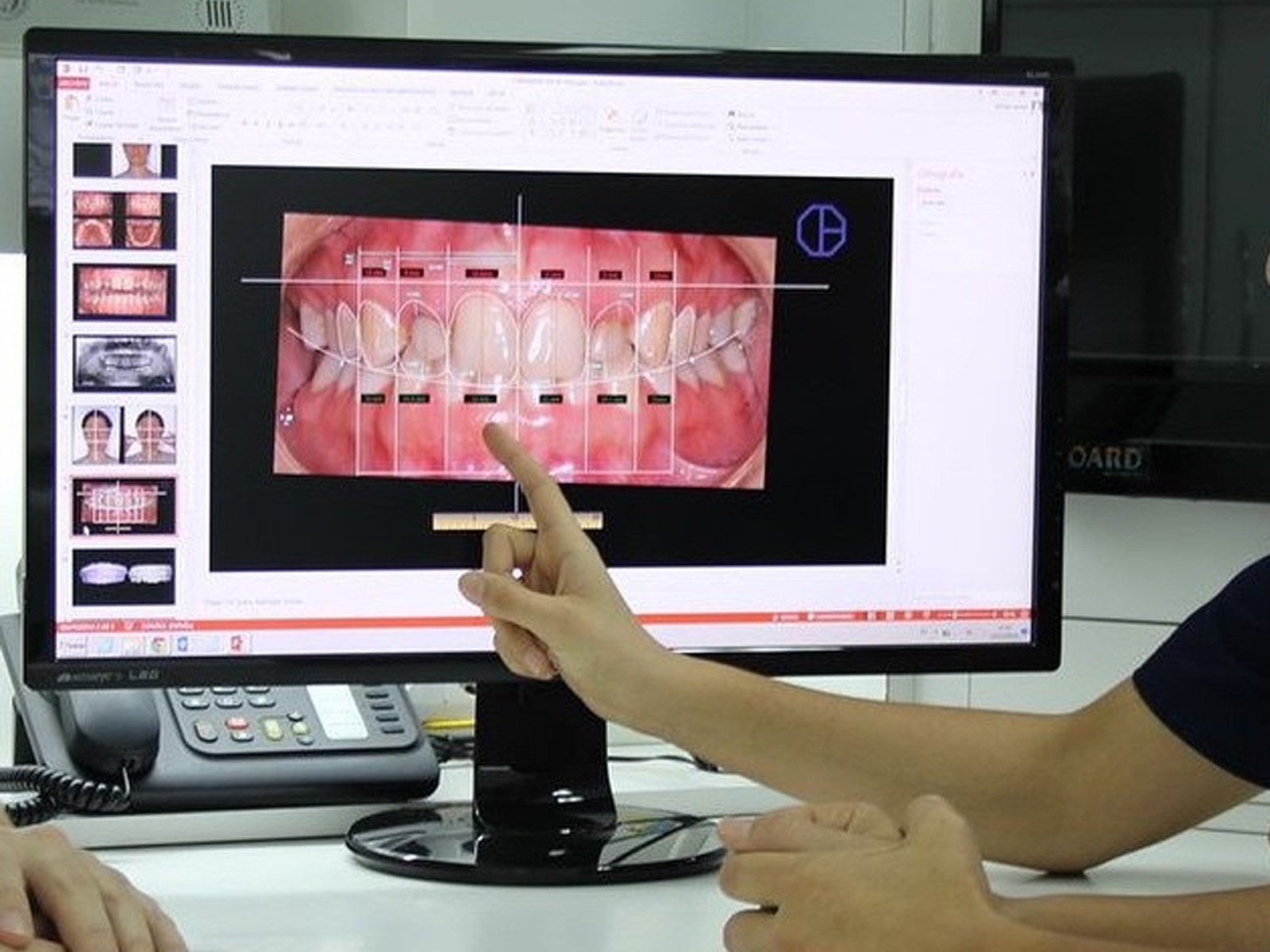طراحی لبخند دیجیتال - کلینیک دندانپزشکی دکتر کاردگر در تهران جردن