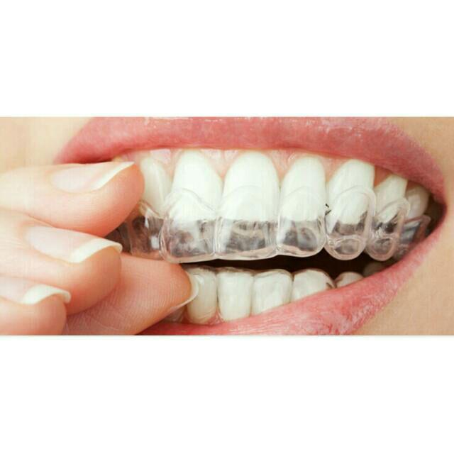 بلیچینگ دندان در خانه یا Home Bleaching